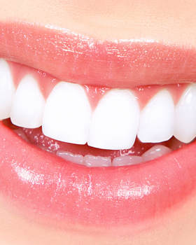 Teeth Whitening